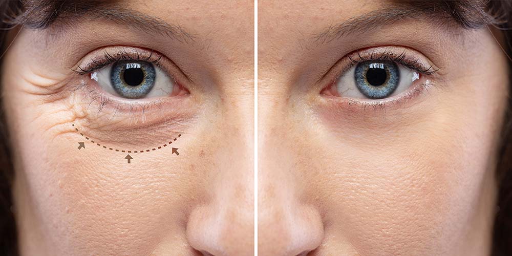 different-types-of skin-blemishes-blog