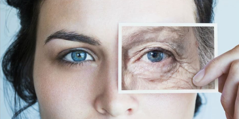 laser-eye-wrinkle-treatment